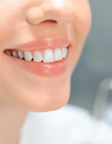 Proporción de dientes Diseño de sonrisa
